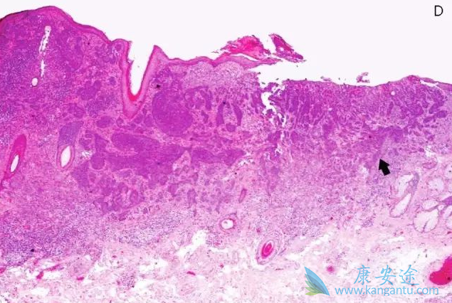 ����ϸ����