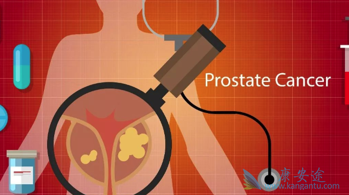 �ۼ��ذ�������