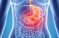 ��������ɷ�ֹ�������������󸴷���