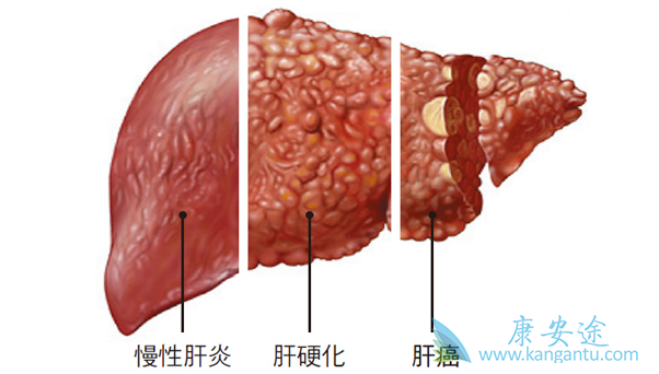 ��Ӳ����ô����