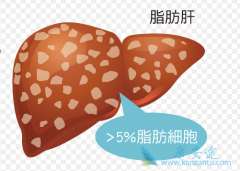 �Ǿƾ���֬���β��ķ������غ�֢״����Щ��