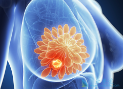 ���Ԥ�����ٰ�������ǰ���Ӱ������Ƶ���Ч��