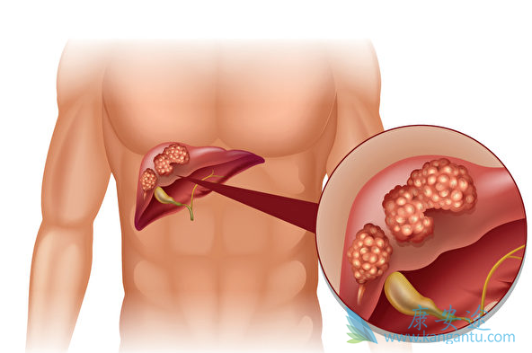 �ΰ�����֢״