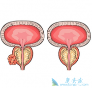 ת����ǰ���ٰ�������Ҫ�����Щ����ͻ�䣿