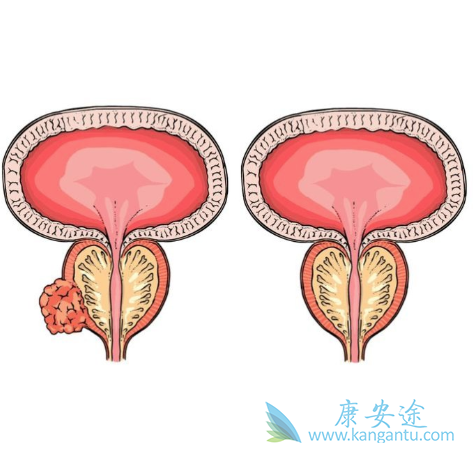 ת����ǰ���ٰ�