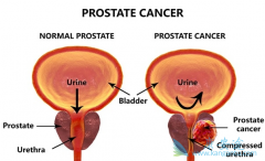 ��������ת��֮��ǰ���ٰ��ܻ��ã�