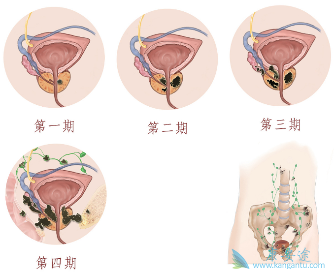 ǰ���ٰ�����