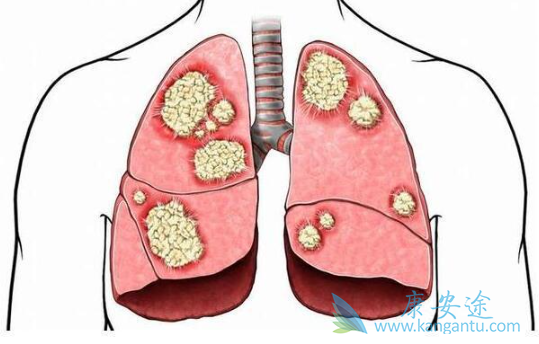 �ΰ�����֢״