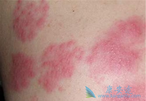 Ƥ����ô����