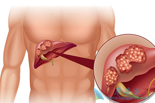 �ΰ�������ʲô֢״