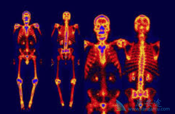 ��֢��ת��