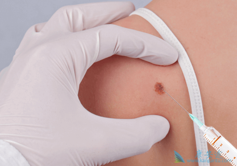 ���Ժ�ɫ����