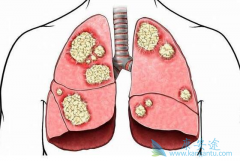 �ΰ��������κ��𣿳����������ǻ�����Щ�µ�ѡ��