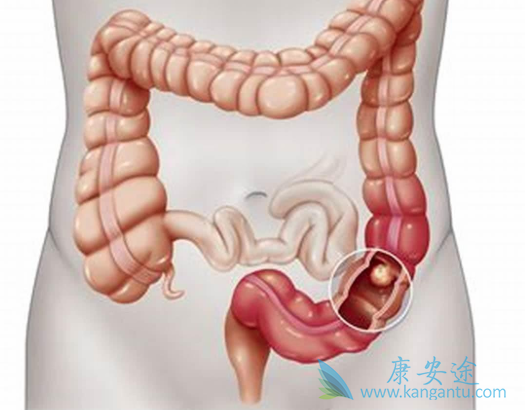 ��ֱ����