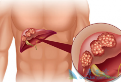 �Ҹβ�����Ⱦ�ǵ���ԭ���Ըΰ���һ��ԭ��֮һ��