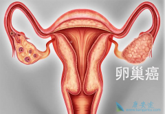 ��ͬ�ѳ����ķ���֢״�ֱ��������ģ�