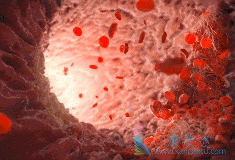 ������ϸ����Ѫ��