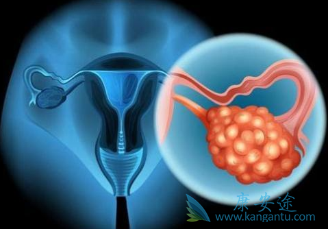 尼拉帕尼 尼拉帕尼