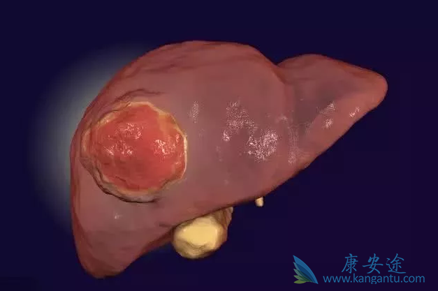 �ΰ��������κ���