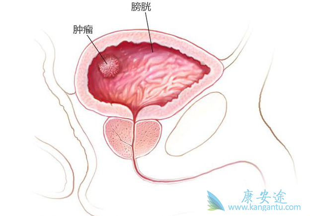 ���װ�������֢״