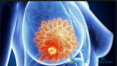 ��Щ���ؿ������շ����ٰ���ԭ��