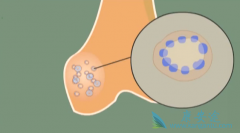 ����Ů��ʹ��˫�����κ����ǵ��͹ɹǹ��۵ķ��ո���