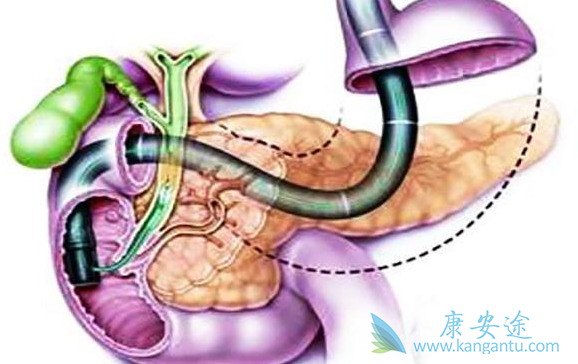 ���ٰ�������