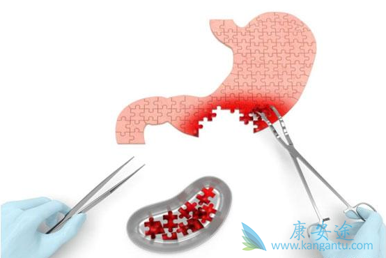 ����ת��