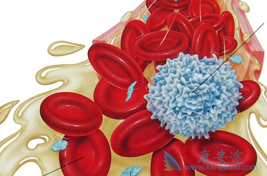 慢性粒细胞白血病 慢性粒细胞白血病