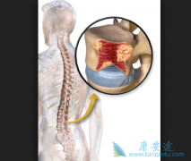 ʲô�ǹ��谩�������������ƹ��谩��