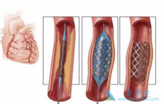 ����֧��������ƭ����������֧���������������