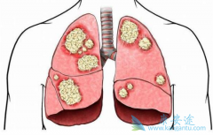 ��������ܷ���Ϊ��Сϸ���ΰ���һ����ҩ��