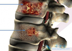 ���ù�����ֲ���������κ���