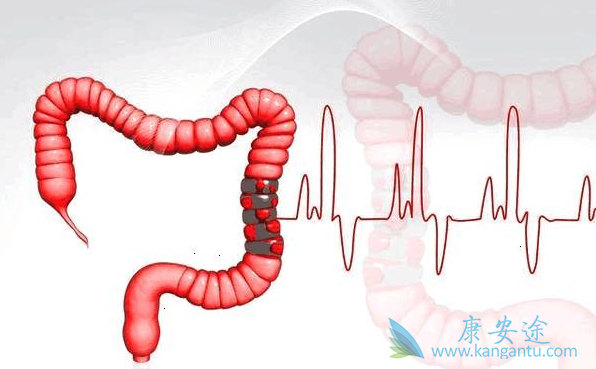 结肠癌的治疗 结肠癌的治疗