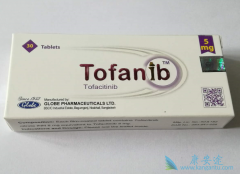 托法替尼(Tofacitinib)能改善白癜风患者的白斑症状