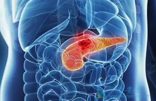 胰腺癌晚期能活多久 胰腺癌晚期能活多久