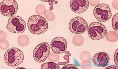 ʹ�ð���ҩ������������Ѫ����ʱ����ͣҩ��