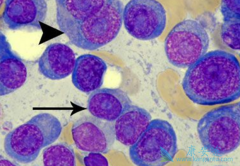 �෢�Թ������������ѡ��ASCT����ʱ����