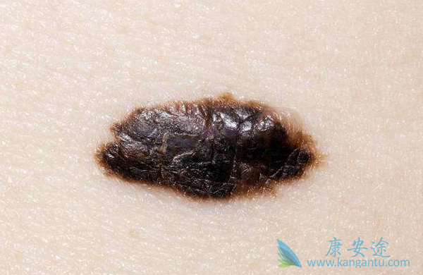 ���Ժ�����