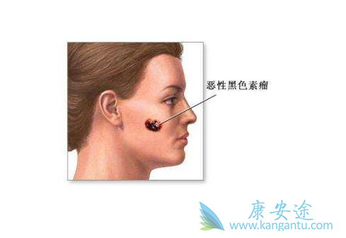 ��ɫ����