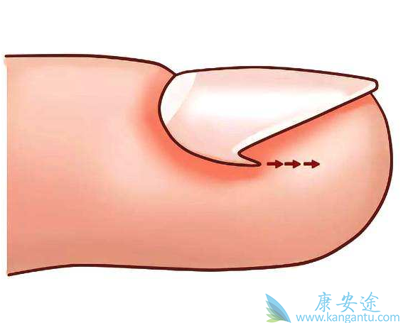 �׹�����ô��