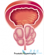 ������ɼ������ǿ���ɶ��й�ǰ���ٰ�������Ч����