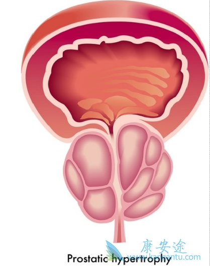 ������ɼ��