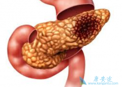 ���ٰ������ܻ��ã����ٰ����Ʒ�������Щ��