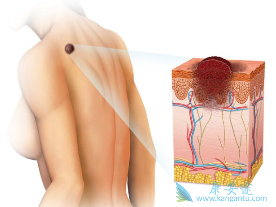 Ƥ������