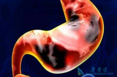 pd1ҩ��������θ������������ʲô��չ��