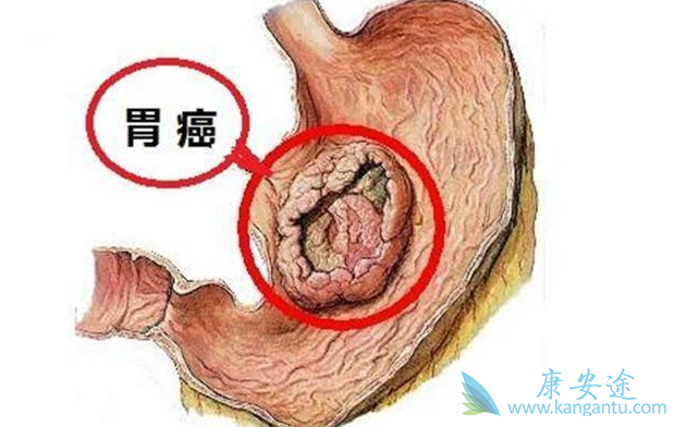 θ��������