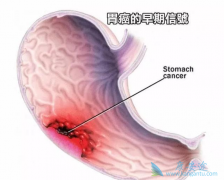 θ������֢״����ͨ������Щ��