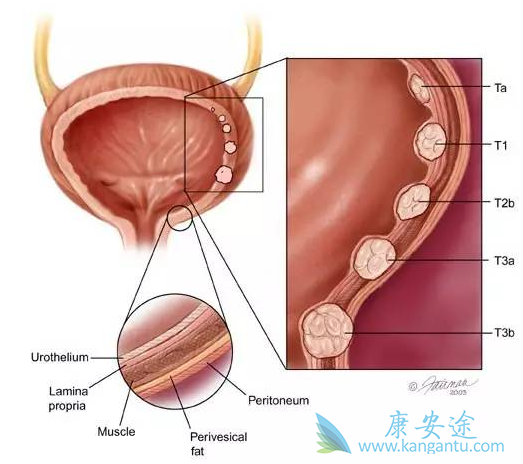 ��·��Ƥ��