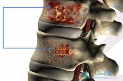 �෢�Թ�����/���谩���׷�֢״ǧ�����